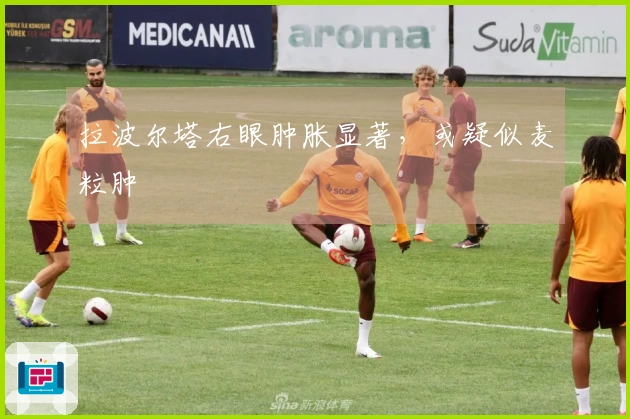 拉波尔塔右眼肿胀显著，或疑似麦粒肿